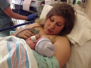 early breastfeeding positioning 